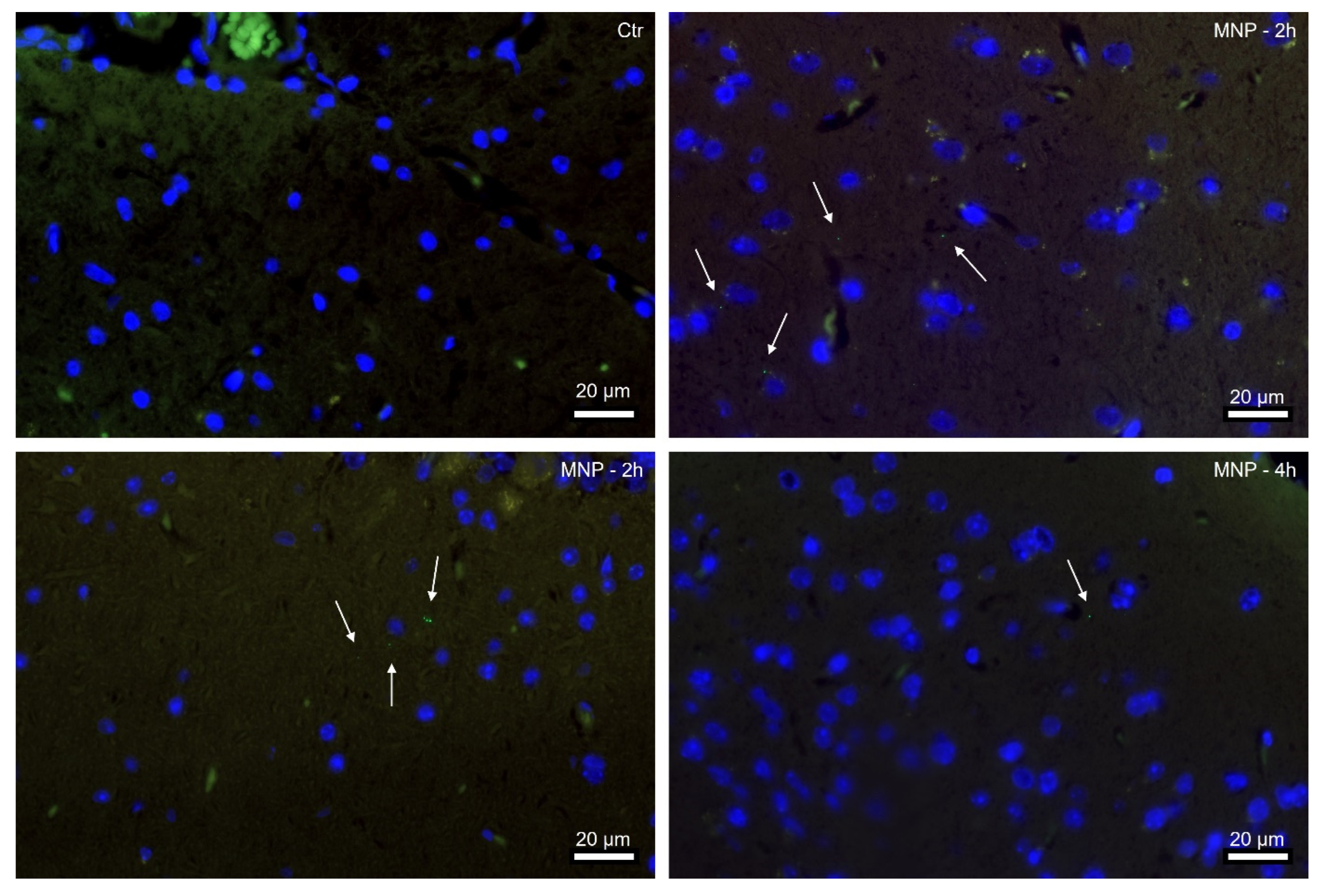 Only two hours after the nanoparticles labelled with green fluorescent markers were ingested, they were visible in the brains of the mice. 
