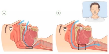 How the direction and volume of air you breathe changes between mouth breathing (A) and nose breathing (B)