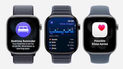 Dit is de Apple Watch 11.